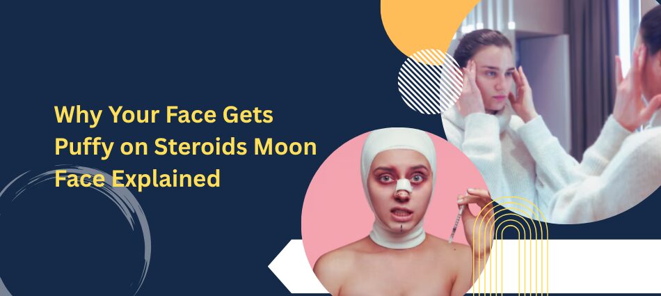 Banner for an article: 'Why Your Face Gets Puffy on Steroids Moon Face Explained' with a collage of medical imagery and a puffy-face portrait in pink circle (informational).